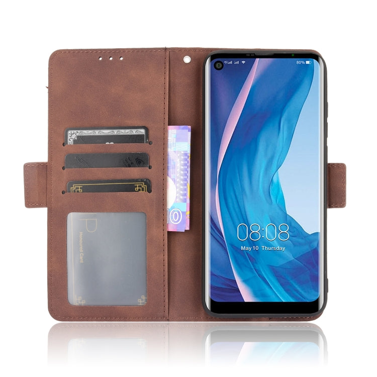 For Ulefone Note 11P Skin Feel Calf Pattern Horizontal Flip Leather Case with Holder & Card Slots & Photo Frame(Brown) - Ulefone Cases by PMC Jewellery | Online Shopping South Africa | PMC Jewellery | Buy Now Pay Later Mobicred