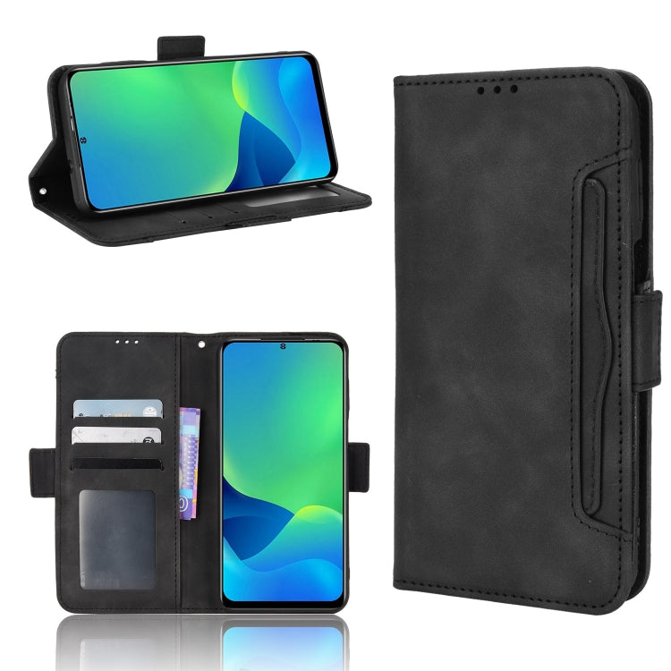 For Ulefone Note 13P Skin Feel Calf Pattern Leather Phone Case(Black) - Ulefone Cases by PMC Jewellery | Online Shopping South Africa | PMC Jewellery | Buy Now Pay Later Mobicred