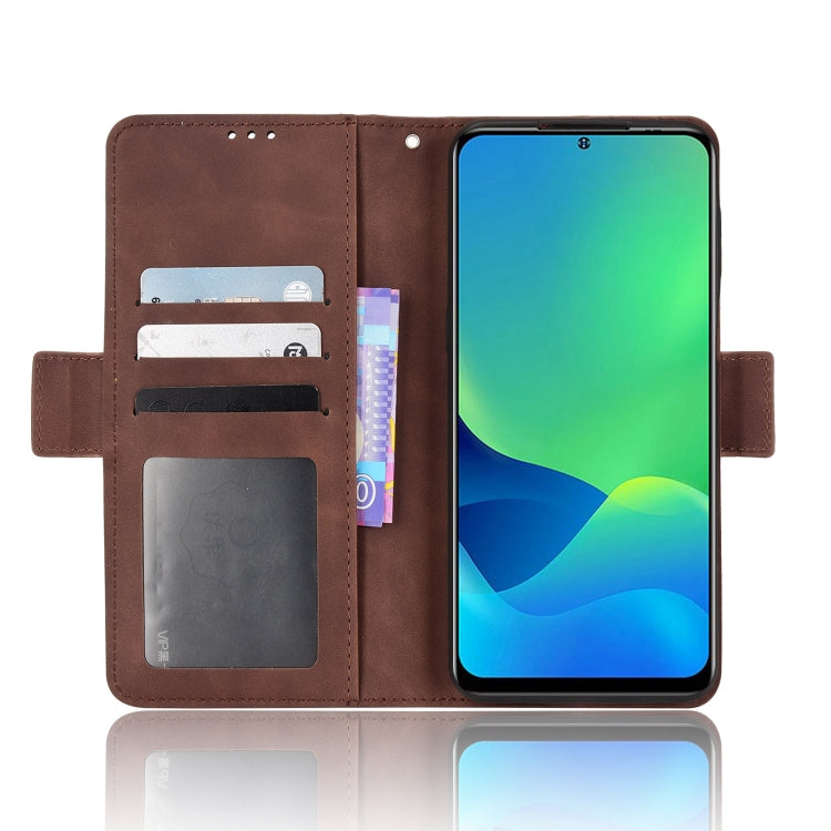 For Ulefone Note 13P Skin Feel Calf Pattern Leather Phone Case(Brown) - Ulefone Cases by PMC Jewellery | Online Shopping South Africa | PMC Jewellery | Buy Now Pay Later Mobicred