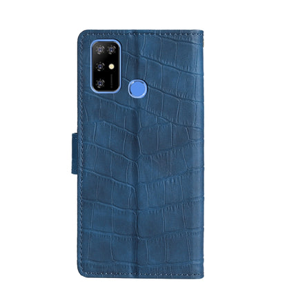 For Doogee X96 Pro Skin Feel Crocodile Magnetic Clasp Leather Phone Case(Blue) - Doogee Cases by PMC Jewellery | Online Shopping South Africa | PMC Jewellery | Buy Now Pay Later Mobicred