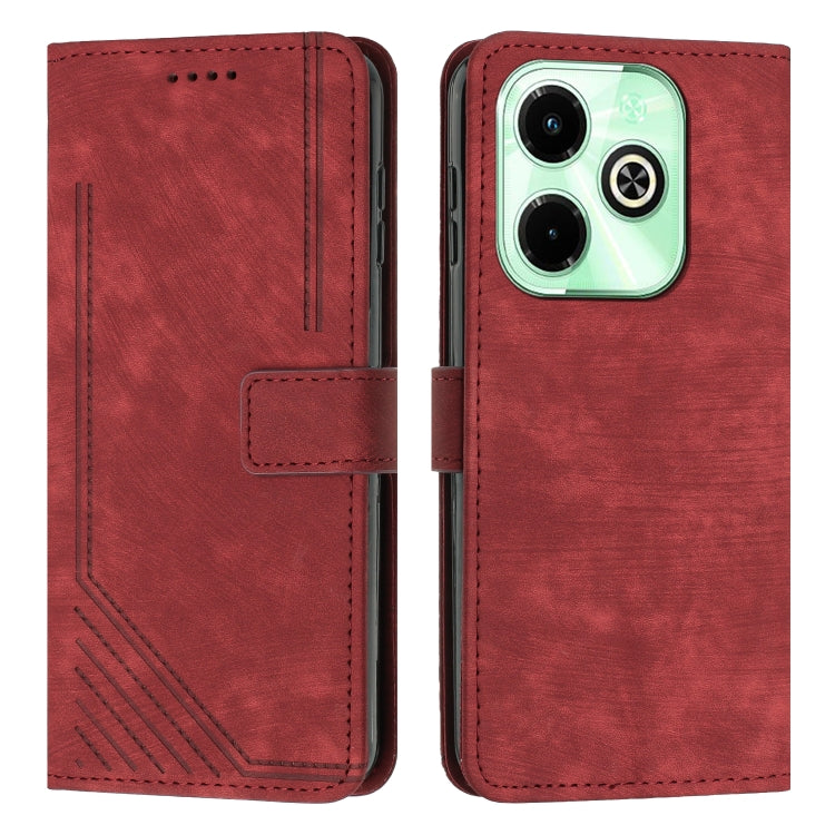 For Infinix Hot 40i Skin Feel Stripe Pattern Leather Phone Case with Lanyard(Red) - Infinix Cases by PMC TechLife | Online Shopping South Africa | PMC TechLife | Buy Now Pay Later Mobicred