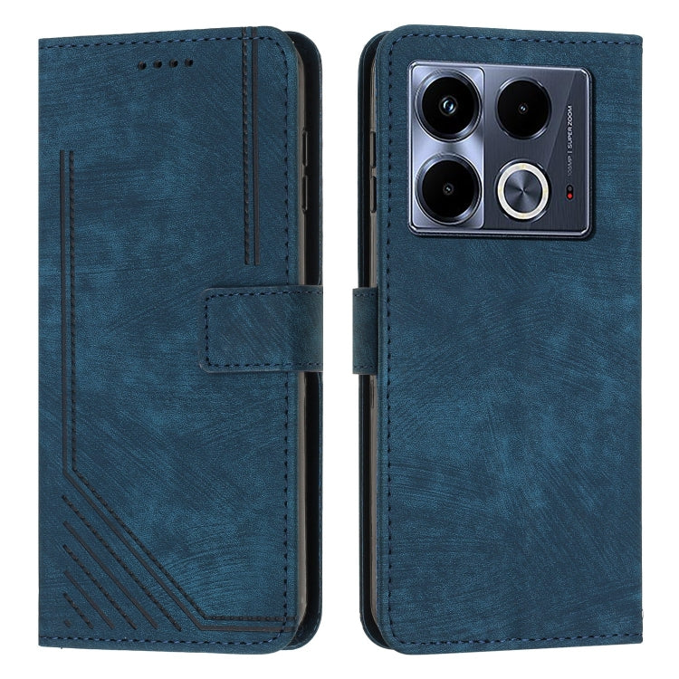 For Infinix Note 40 4G Skin Feel Stripe Pattern Leather Phone Case with Lanyard(Blue) - Infinix Cases by PMC TechLife | Online Shopping South Africa | PMC TechLife | Buy Now Pay Later Mobicred