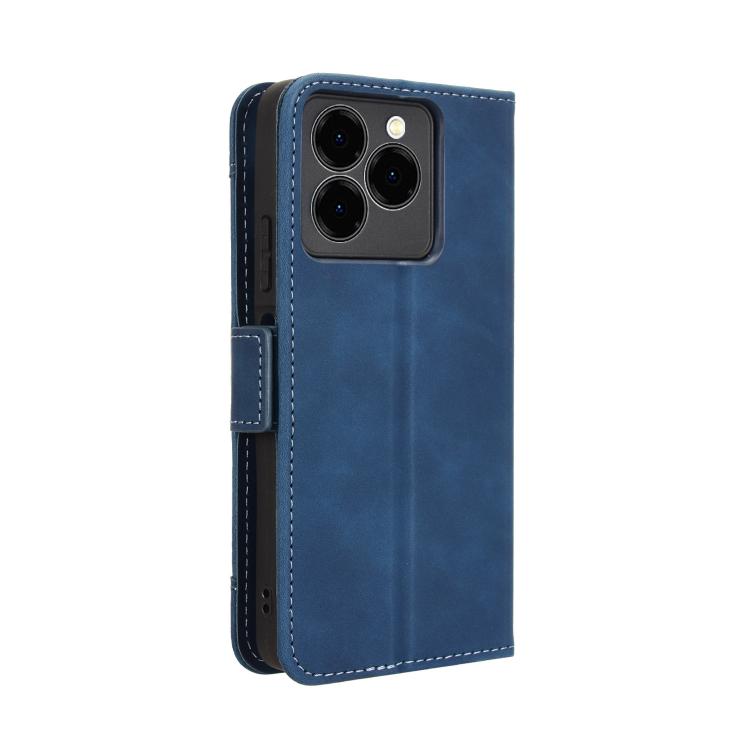 For Ulefone Note 20 Pro Skin Feel Calf Texture Card Slots Leather Phone Case(Blue) - Ulefone Cases by PMC TechLife | Online Shopping South Africa | PMC TechLife | Buy Now Pay Later Mobicred
