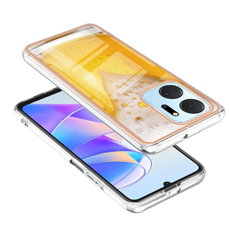 For Honor X7a Electroplating Marble Dual-side IMD Phone Case(Draft Beer) - free shipping - PMC TechLife - Order now!