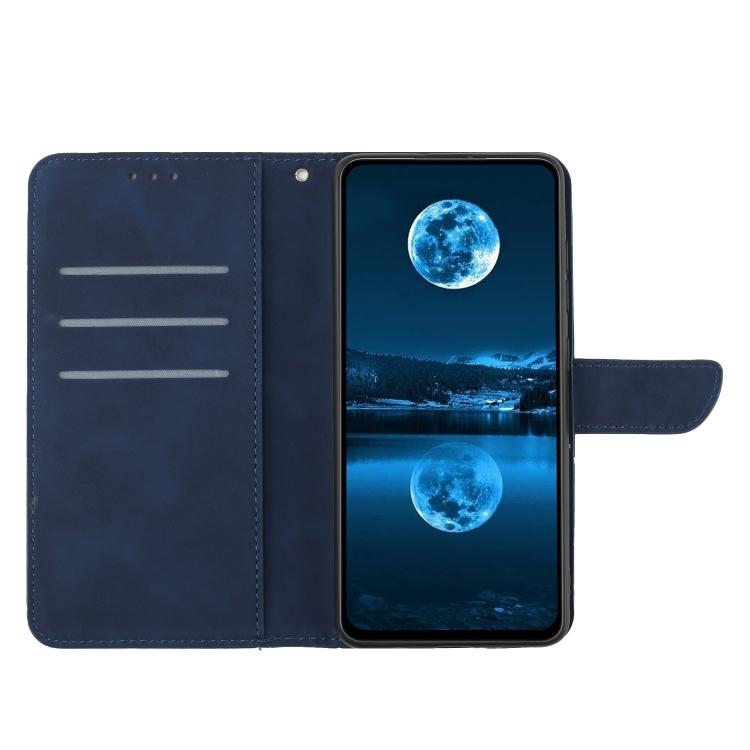 For Tecno Pova 7 5G Stitching Embossed Leather Phone Case(Blue) - free shipping - PMC TechLife - Order now!