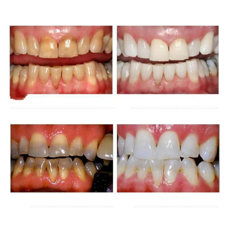 Professional Nano Teeth Whitening Oral Cleansing Set - Teeth Whitening by PMC TechLife | Online Shopping South Africa | PMC TechLife