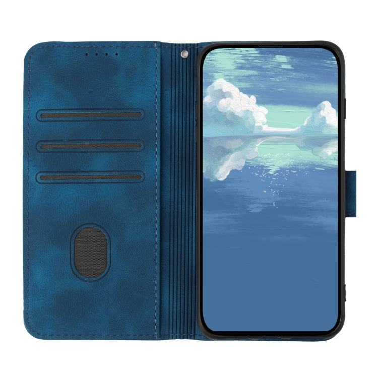 For Honor 70 Lite Line Pattern Skin Feel Leather Phone Case(Royal Blue) - free shipping - PMC TechLife - Order now!