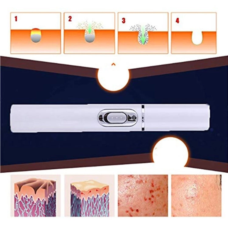 K-SKIN KD-7910 Acne Laser Pen Portable Wrinkle Removal Machine Durable Soft Scar Remover Device Blue Light Therapy Pen - Beauty Instrument by K-SKIN | Online Shopping South Africa | PMC Jewellery | Buy Now Pay Later Mobicred