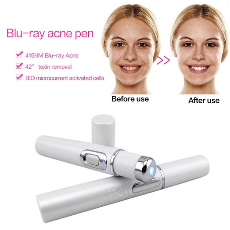 K-SKIN KD-7910 Acne Laser Pen Portable Wrinkle Removal Machine Durable Soft Scar Remover Device Blue Light Therapy Pen - Beauty Instrument by K-SKIN | Online Shopping South Africa | PMC Jewellery | Buy Now Pay Later Mobicred