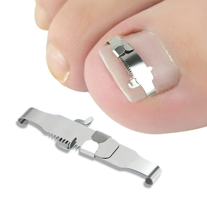 Orthopedic Buckle Toe Nail Groove Ingrown Nail Corrector, Style:No. 42, Specifications:Set - Corrector by PMC Jewellery | Online Shopping South Africa | PMC Jewellery