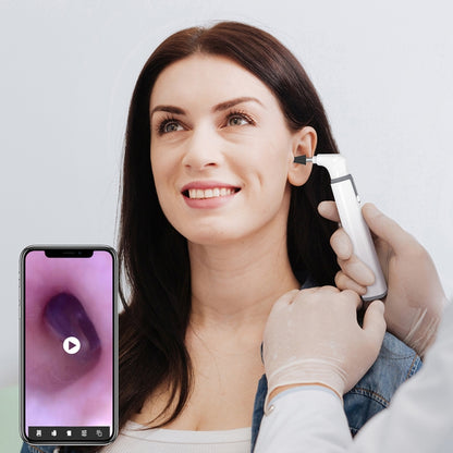 TESLONG SA39W 3.9mm Camera Lens WiFi Smart Visual Ear Scoop(SA39W) - Ear Care Tools by TESLONG | Online Shopping South Africa | PMC Jewellery